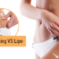 CoolSculpting VS Lipo