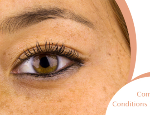 What are the Most Common Skin Conditions?