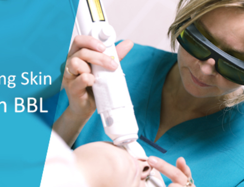 How is BroadBand Light Useful in Treating Skin?