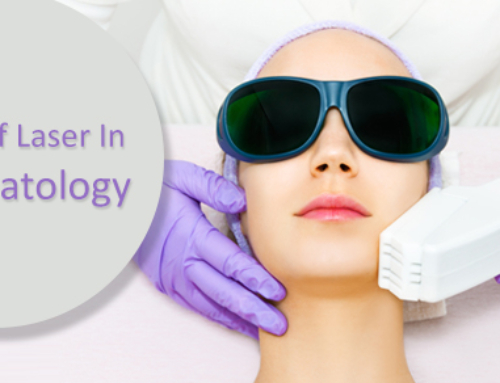 Uses of Laser in Dermatology