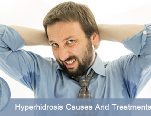 Causes And Treatments of Hyperhidrosis