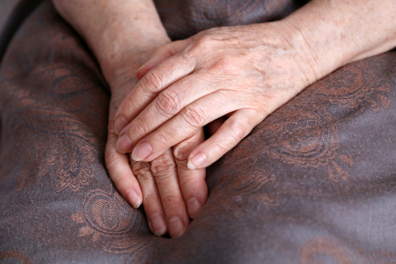 woman's hands in lap showing age spots and age damage