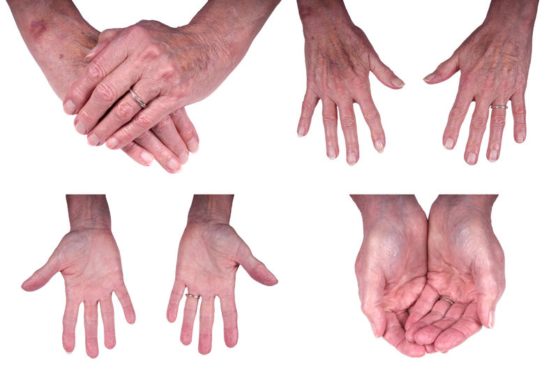 aging hands