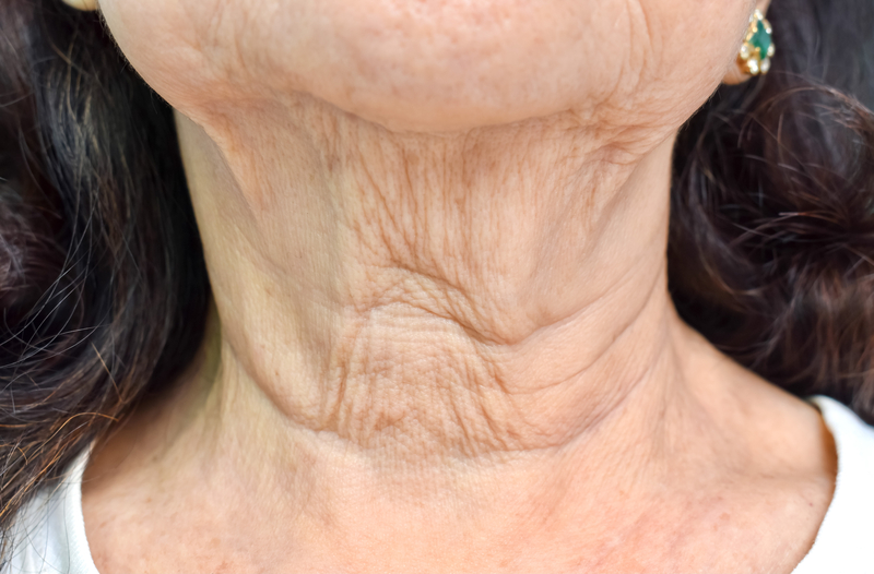 close view of wrinkled neck