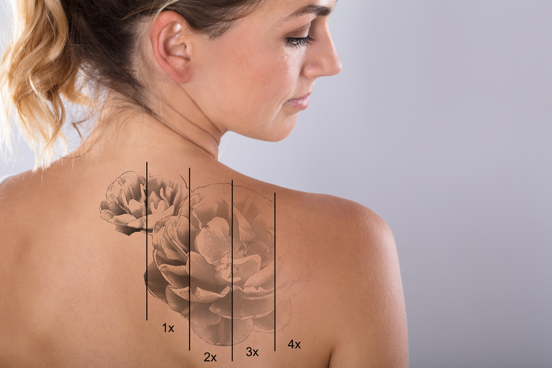 woman with flower tattor on back right shoulder showing fading of tattoo